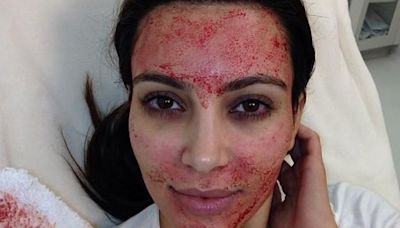 Women Diagnosed With HIV After “Vampire Facial” Procedures Popularized by Kim Kardashian