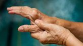 Rheumatoid arthritis drug abatacept may also prevent the disease