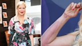 Tori Spelling Says She's 'Wearing My Thigh on My Arm' from Skin Graft After Falling on a Hot Hibachi Grill