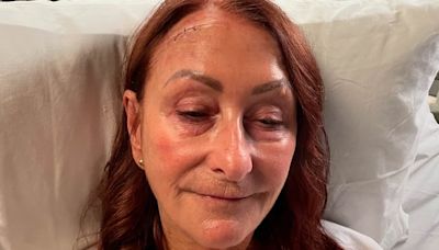 Lynne McGranger sparks concern as she shares photos of shock injuries