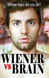 Wiener vs Brain