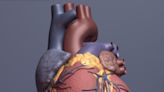 Biomimetic transcatheter aortic heart valve offers new option for aortic stenosis patients