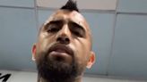 Arturo Vidal reacciona al fichaje de Medel en Boca y le envía este mensaje: “Siempre...”