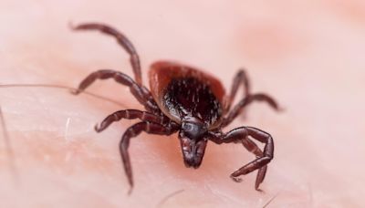 Could You Have Lyme Disease and Not Know It?