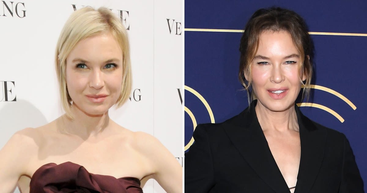 Renee Zellweger's Shocking Face Transformation [Photos]