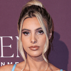 Former 'Dancing With the Stars' Contestant Lele Pons Reveals Vicious Dog Attack on Game Show