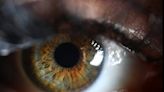 Are you one of the millions about to have cataract surgery? Here’s what ophthalmologists say you need to know