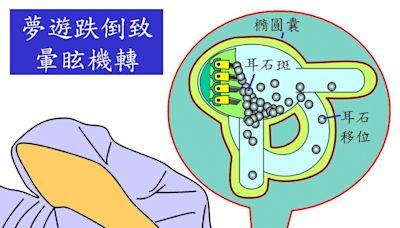 〈耳鳴暈眩保健專欄〉使用Z字頭助眠藥 夢遊跌倒致暈眩