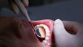 Gum disease: causes, risks, prevention and when to see your dentist