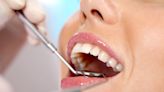 Wanting to get your teeth fixed? Beware of unlicensed 'veneer techs', dentists warn