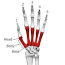 Metacarpal bones