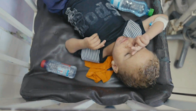 Dangerous skin diseases add to the turmoil of war for children in Gaza