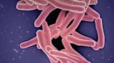 Tuberculosis is spreading in California, officials say. Silent bacteria could be why