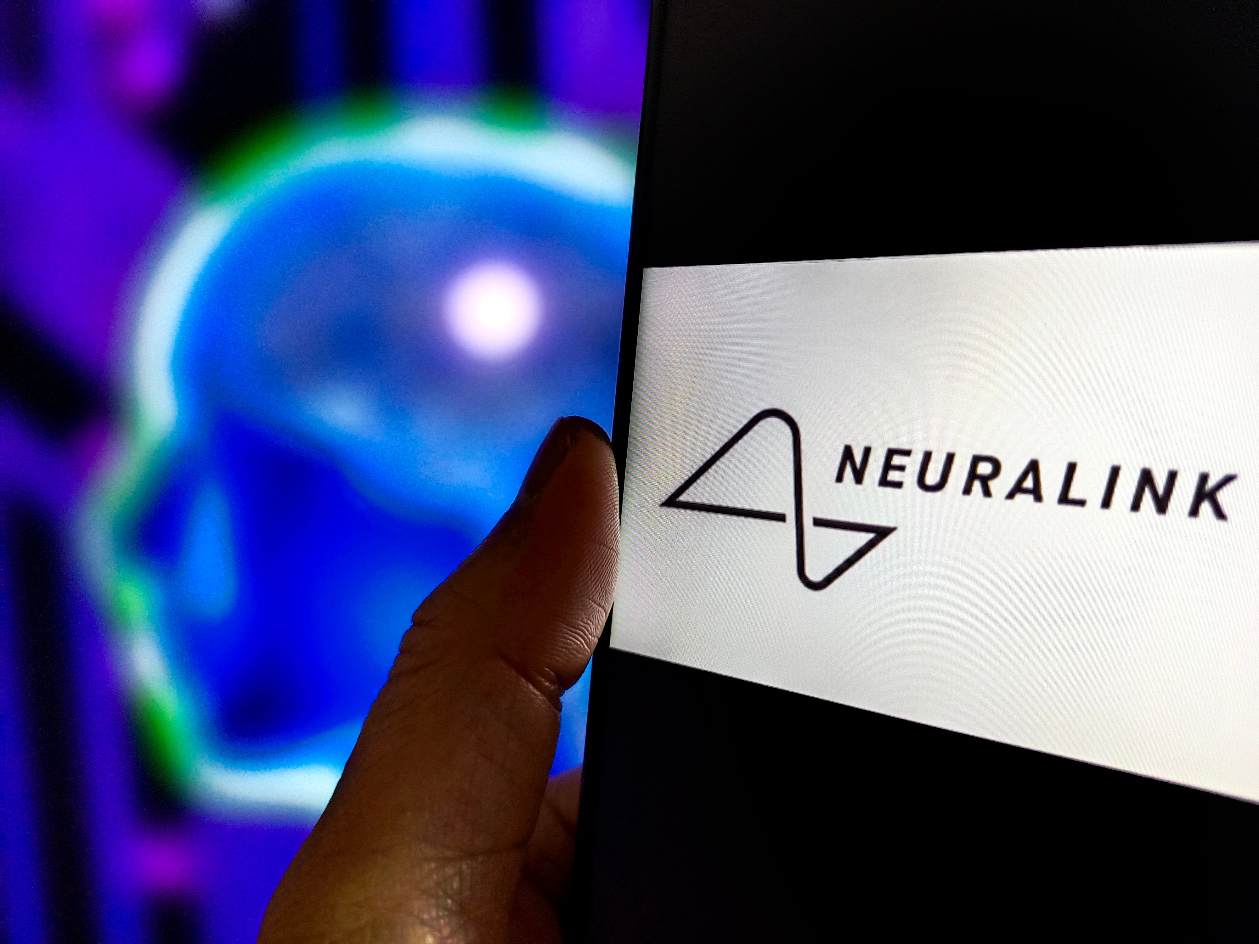 Neuralink's brain-chip implant malfunctioned, and the company reportedly considered removing it from its human patient