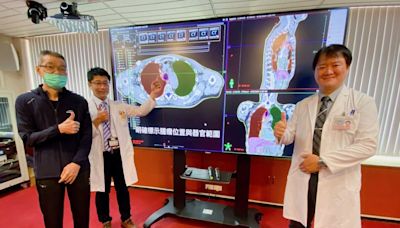人工1小時AI只要2分鐘 中榮放療結合AI精準勾畫減少副作用