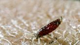 Do body lice spread plague? Science suggests the blood-suckers may have played a surprising role