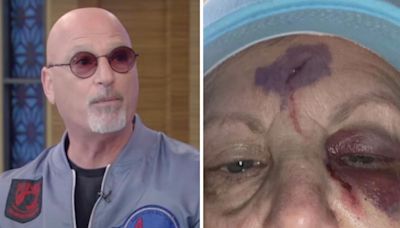 Howie Mandel tells 'Live' he "freaked" after seeing his wife’s "skull" following a brutal drunken fall