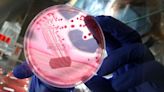 CDC investigating ‘fast-moving’ E. coli outbreak that has sickened dozens