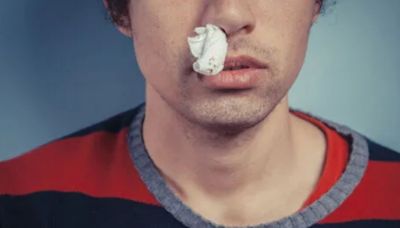 Nosebleeds That Last More Than This Many Minutes May Require An A&E Visit