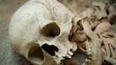 Death Investigator Identifies Mysterious Skull Found In Plastic Bag | ALT 104.5