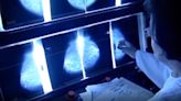 National health panel recommends mammograms start at 40