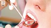 免費口腔檢查今起登記 學會冀市民培養定期洗牙習慣