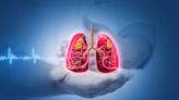 Roche’s Phase II/III NSCLC treatment trial fails to meet primary endpoints