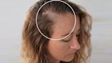 Women praise hair growth serum that makes 'a drastic and obvious improvement'