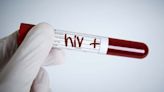 HIV Patients Cured Through Risky Transplant Are Now "Living Proof" Of Hope