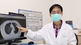 50年老菸槍掛號戒菸門診 意外查出早期肺腺癌