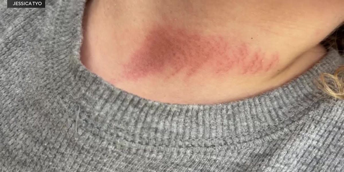 Woman says her son was choked with a jump rope at school