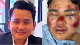 Nepali man brutally attacked from behind and left unconscious while grabbing food in Oakland