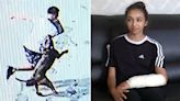 Girl, 11, attacked by XL bully crossbreed in Birmingham says dog should be put down and its owner jailed