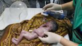 Baby saved from dying mother's womb after Israeli airstrike named in her honor