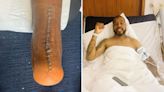Fans ask 'which body part is that?' as PSG star shows off gruesome surgery scar