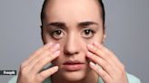 Those under eye dark circles could be indicating a more serious health problem; learn what they are