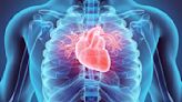 Cofepris autoriza nuevo software para tratamiento de infartos
