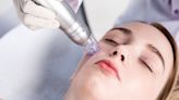 What is microneedling? An expert weighs in on the anti-aging treatment