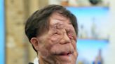 El concursante de ‘Celebrity MasterChef’, Adam Pearson, emite una disculpa “sarcástica” a los espectadores