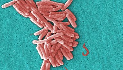 5 people diagnosed with Legionnaires' disease in New Hampshire after possible exposure from cooling tower