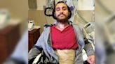 First Neuralink Patient Alarmed as Device Starts Glitching