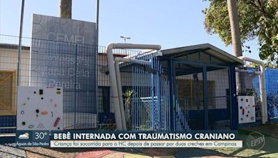 Criança de 1 ano é internada no HC da Unicamp com fratura no crânio e hemorragia