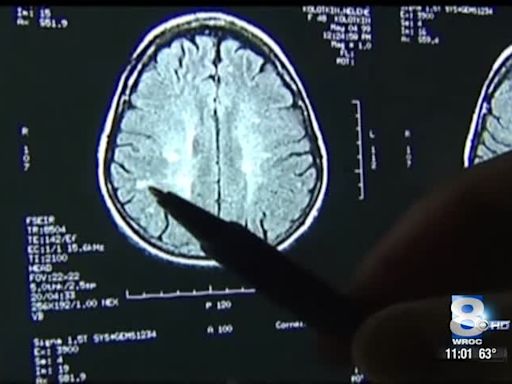 Local Experts: Treatment for concussions is evolving for both long and short term symptoms