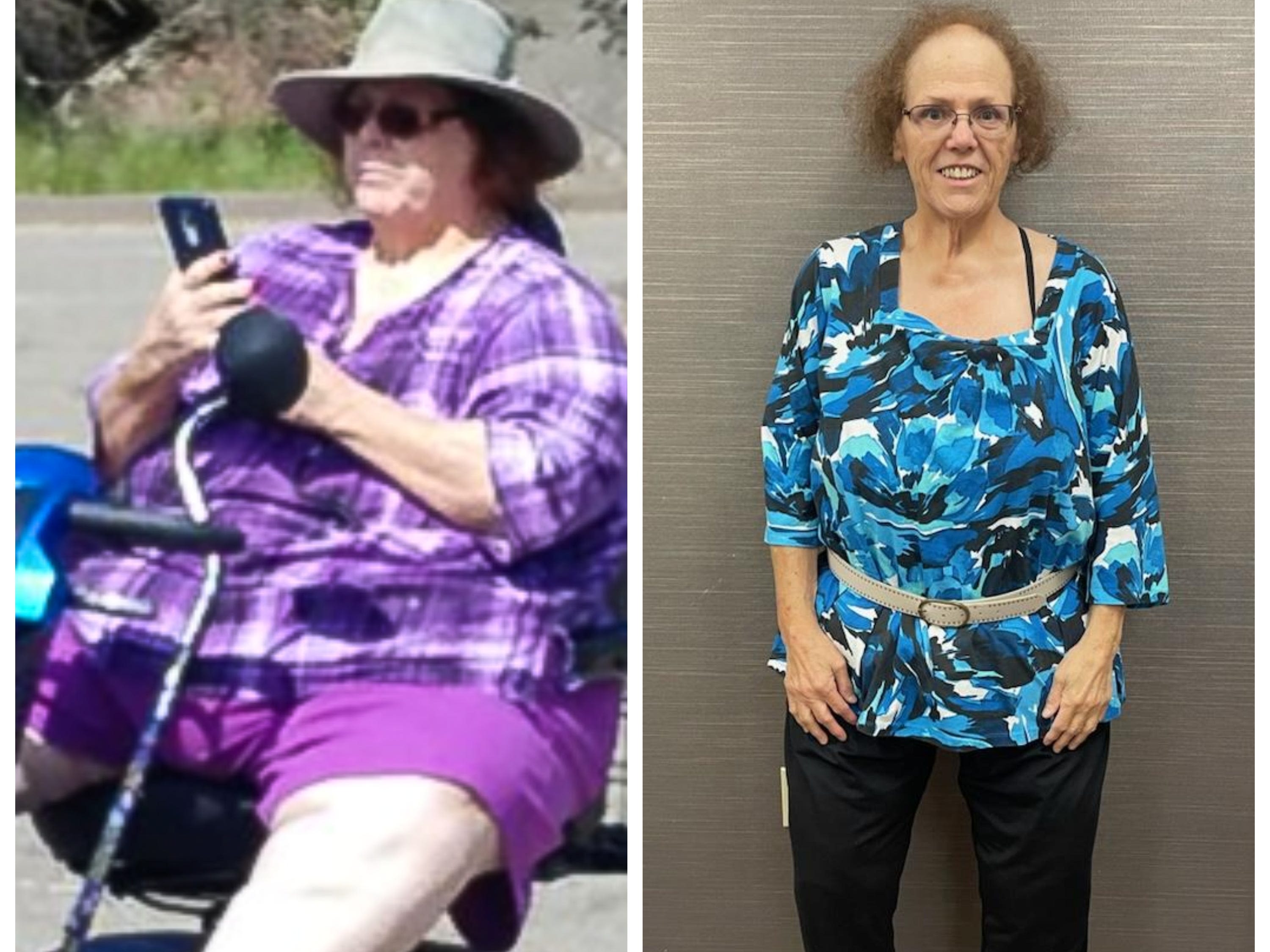 A 73-year-old lost 185 pounds by going to the gym and eating a low-carb diet. She reversed her diabetes and ditched her scooter.