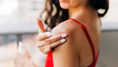 Ever Wonder 'Why Is My Skin Peeling?' It’s Probably From One of These Common Conditions