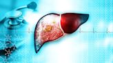 'Dramatic' Phase 2 Results for Survodutide in MASH, Fibrosis