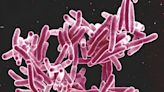 What to know about TB after outbreak in Long Beach sickens 14