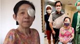吳淑珍切除眼瞼腫瘤 醫揭「這類癌」難察覺：最嚴重恐挖眼！