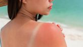 How to protect yourself from skin cancer after survey finds increased number of people at risk