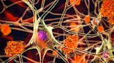 Lifestyle-Dementia Links Persist Regardless of Risk Genes, French Study Shows